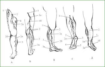 Основные туннельные синдромы ноги